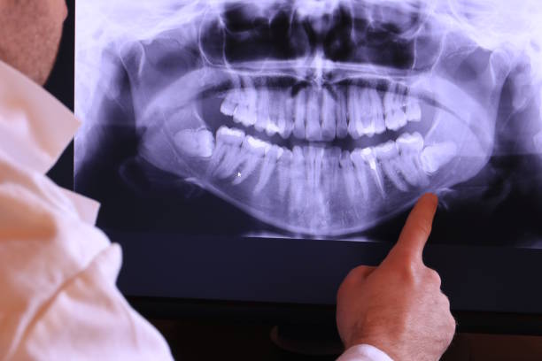 Best Dentist for Tooth Abscess  in Sand Hill, PA
